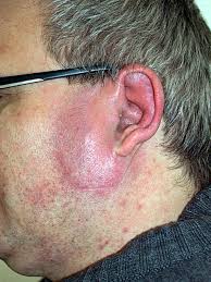 Ohe� svat�ho Anton�na